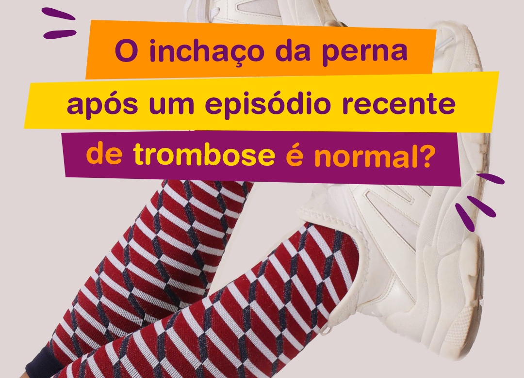 Pernas com meias compressivas e faixas com o texto: "Inchaço da perna após episódio de recente de trombose é normal"?